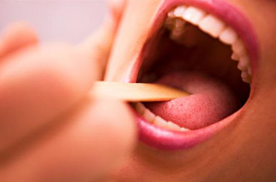մակաբույծների տեսակները մարդու բերանում